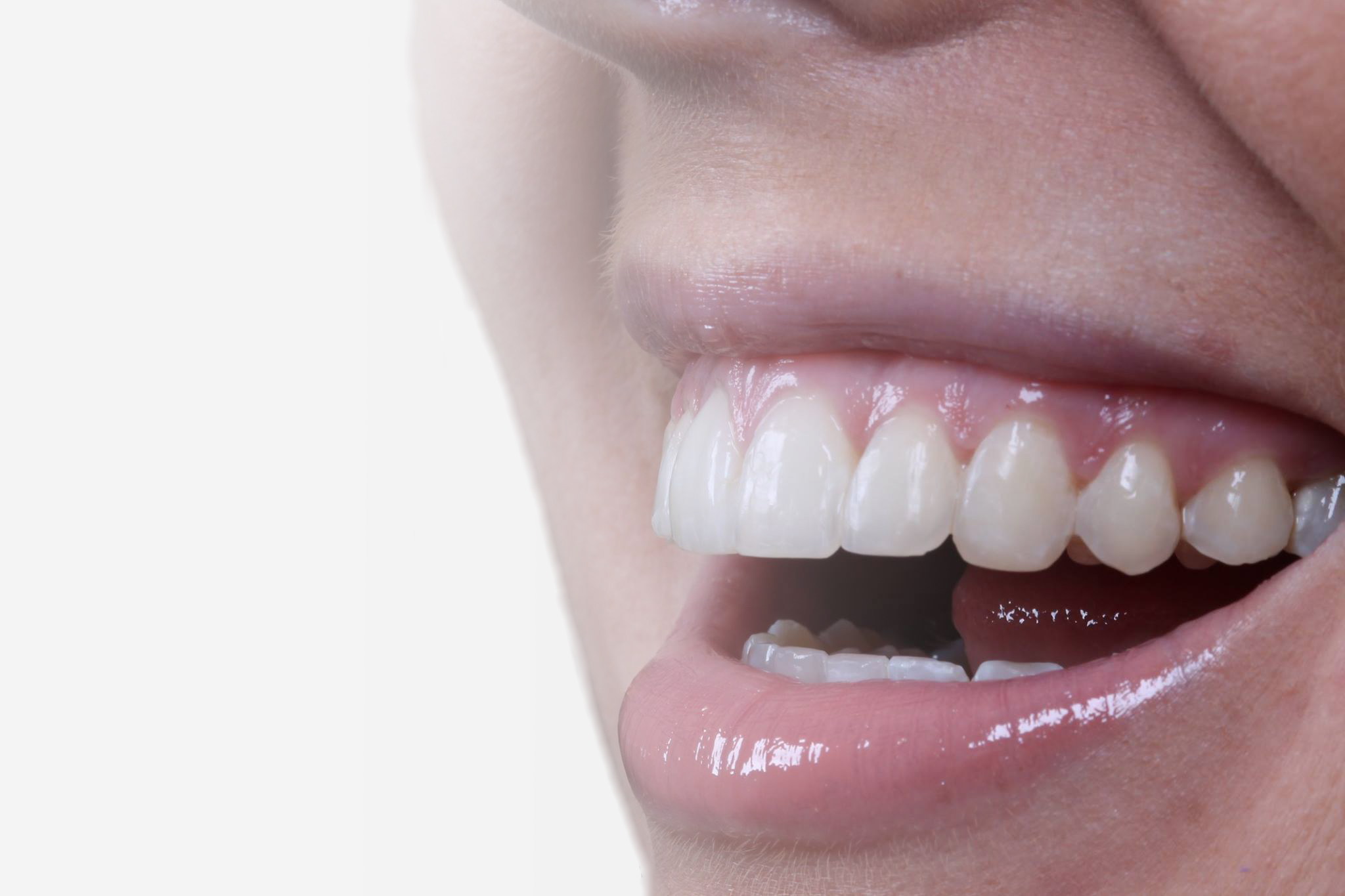 orthodontist, orthodontics, braces, seapoint clinic, straight teeth, orthodontist dublin, teen braces
